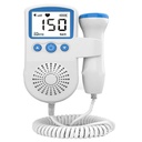 Home Doppler device for monitoring fetal heartbeat
